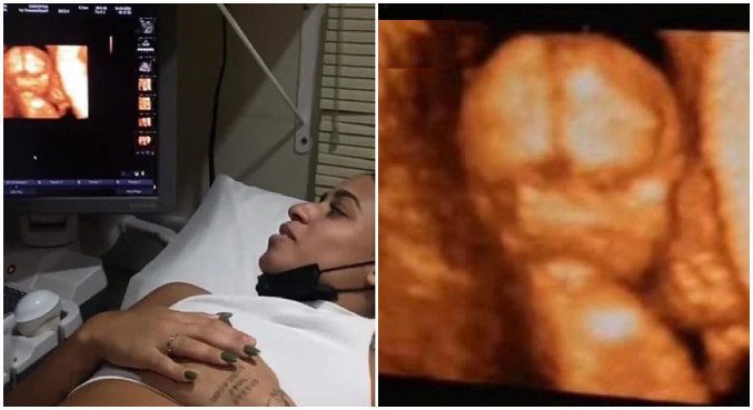 Grávida de 3 meses, MC Loma chora ao fazer novo ultrassom