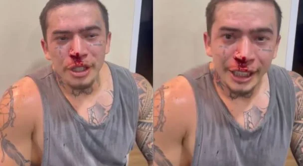 Whindersson Nunes aparece com o rosto cheio de sangue e preocupa os fãs: “Mexi com o cara errado” - Foto: Reprodução / Instagram