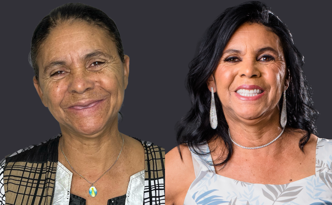 Clínica Central Odontologia Continua Realizando Sonhos E Transformando Vidas 3 Sra. Leonice Exibe O Antes E Depois - Credito Da Foto: Luciano Dos Santos Moraes / Divulgação