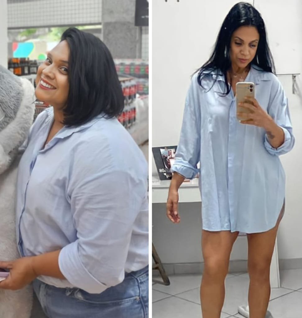 Cirurgias Plásticas Combinadas É Seguro? Dr. Sérgio Cruz Revela Receio Dos Pacientes 3 Img 20231118 Wa00831 Cosmopolitam