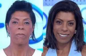 Famosos Aparecem Diferente Depois Da Harmonização Diz A Especialista Livia Camargo 2 Img 0528 Cosmopolitam