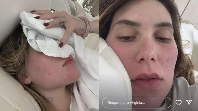 Virginia Fonseca Revela Abstinência Ao Iniciar Novo Tratamento De Saude 2 Virgínia Fonseca - Foto: Instagram