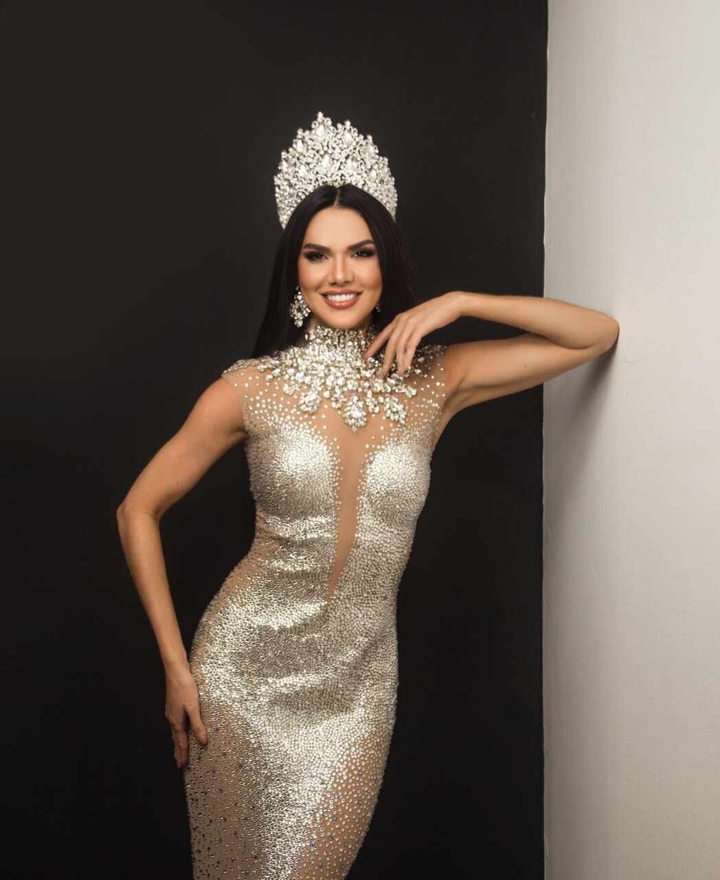 Engenheira Civil, Raquel Albuquerque, é a Miss Universe Pará 2025 18 Raquel Albuquerque - Crédito da Foto: Alle Peixoto / Divulgação