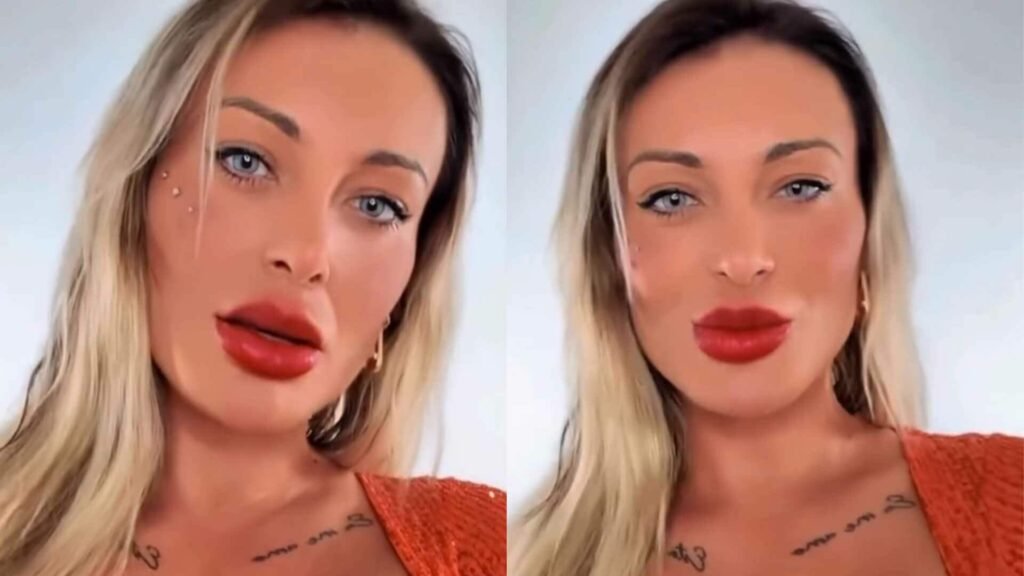Andressa Urach Exibe Resultado De Modificacao Na Cor Dos Olhos Cosmopolitam