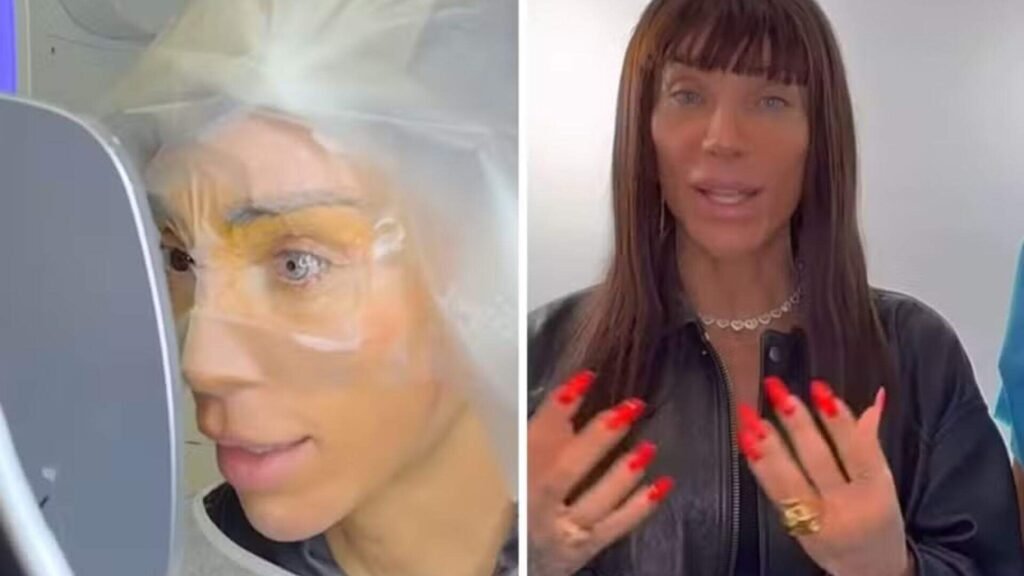 Maya Massafera Mostra Como Foi Cirurgia Para Mudar Cor Dos Cosmopolitam