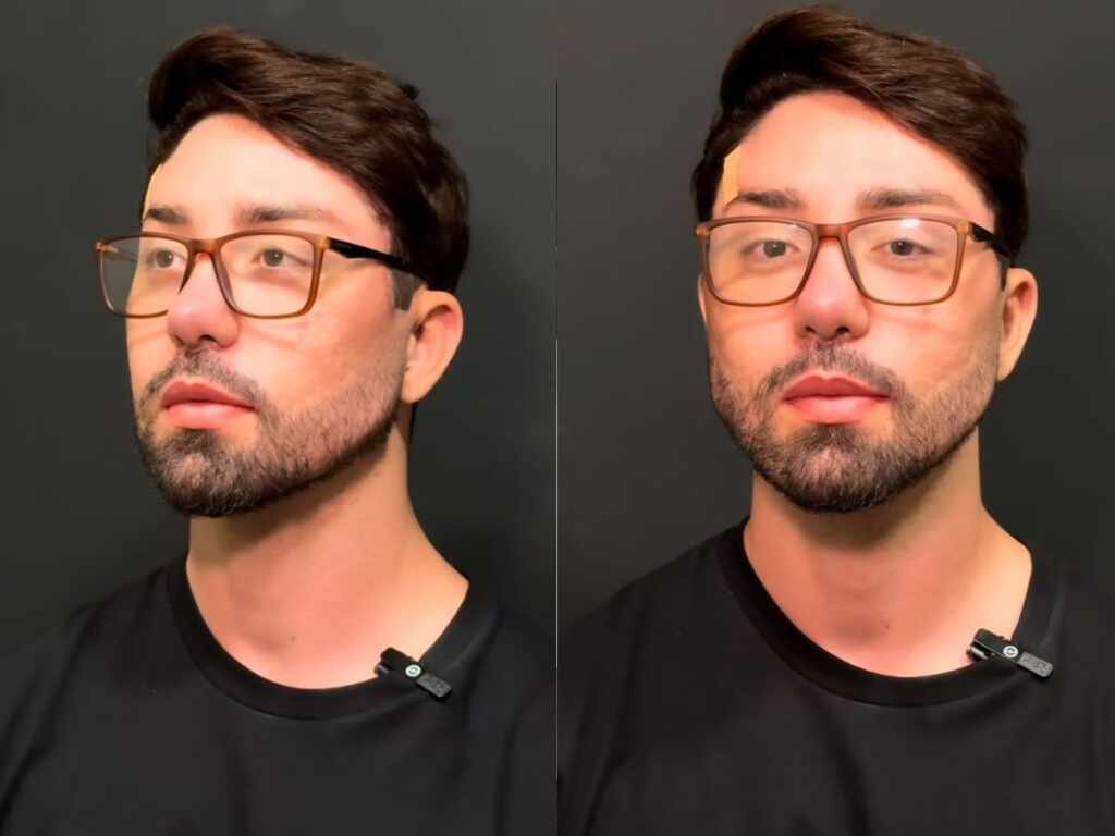 Rico Melquiades é barrado na imigração em Dubai após procedimentos estéticos Rico Melquiades é barrado na imigração em Dubai após procedimentos estéticos - Foto: Instagram