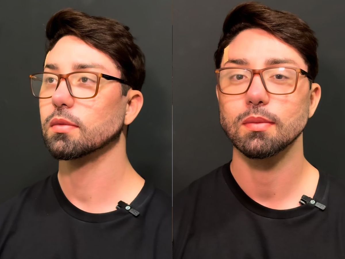 Rico Melquiades é barrado na imigração em Dubai após procedimentos estéticos - Foto: Instagram