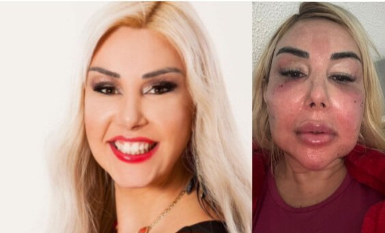 InShot 20251212 171335391