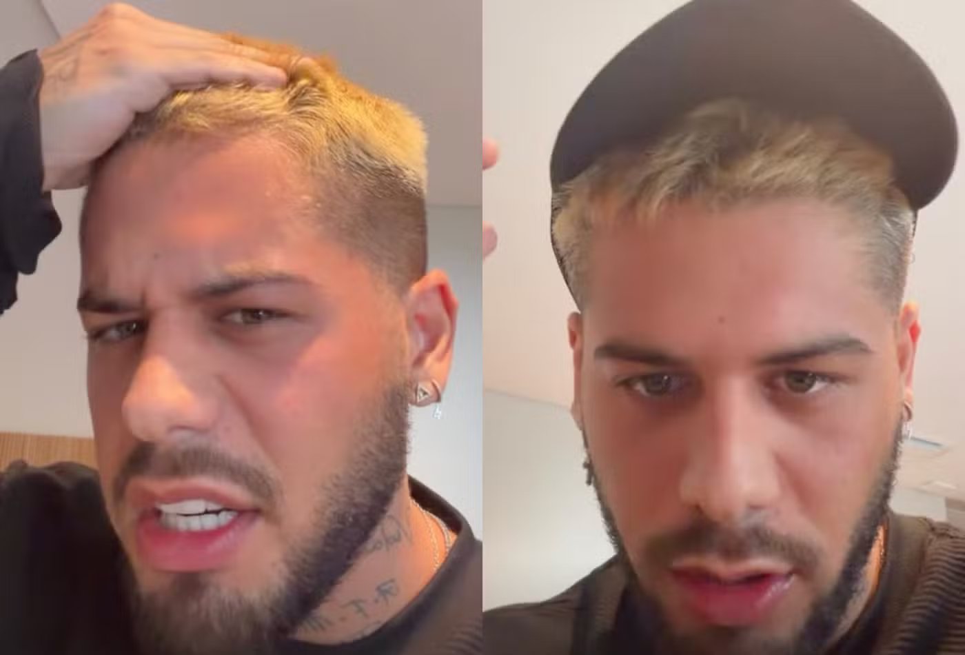 Zé Felipe revela botox, dica da mãe e aposta em cuidados preventivos com a pele